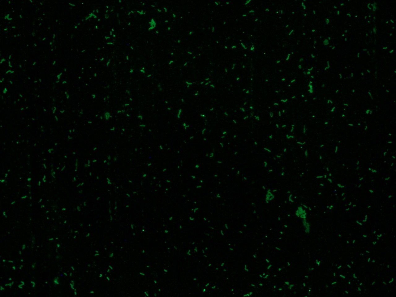 Listeria monocytogenes