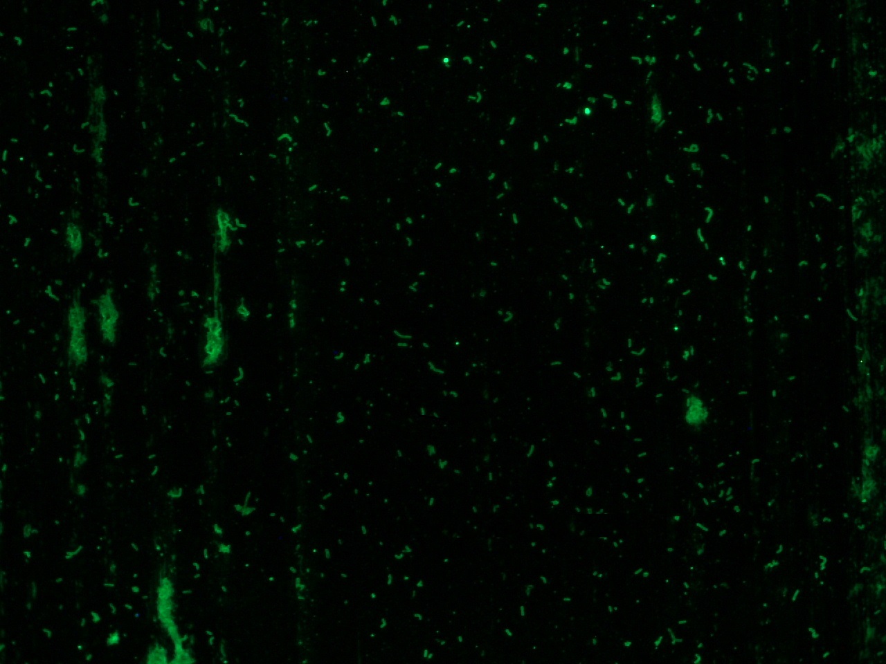 Listeria monocytogenes