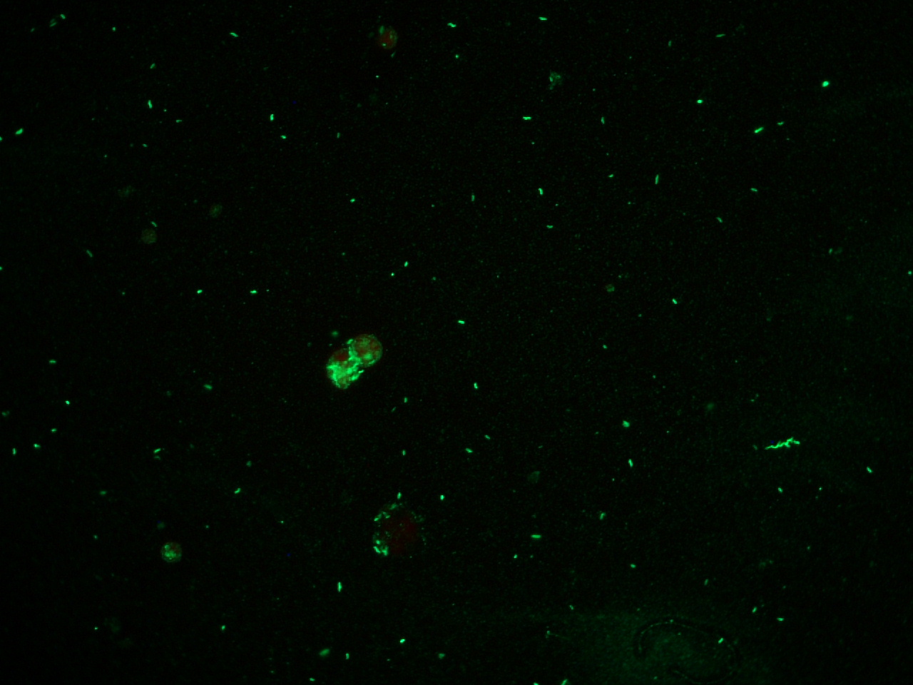 Lawsonia intracellularis