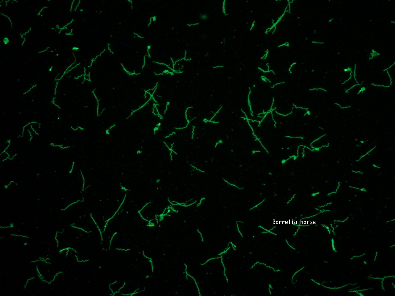 Borrelia