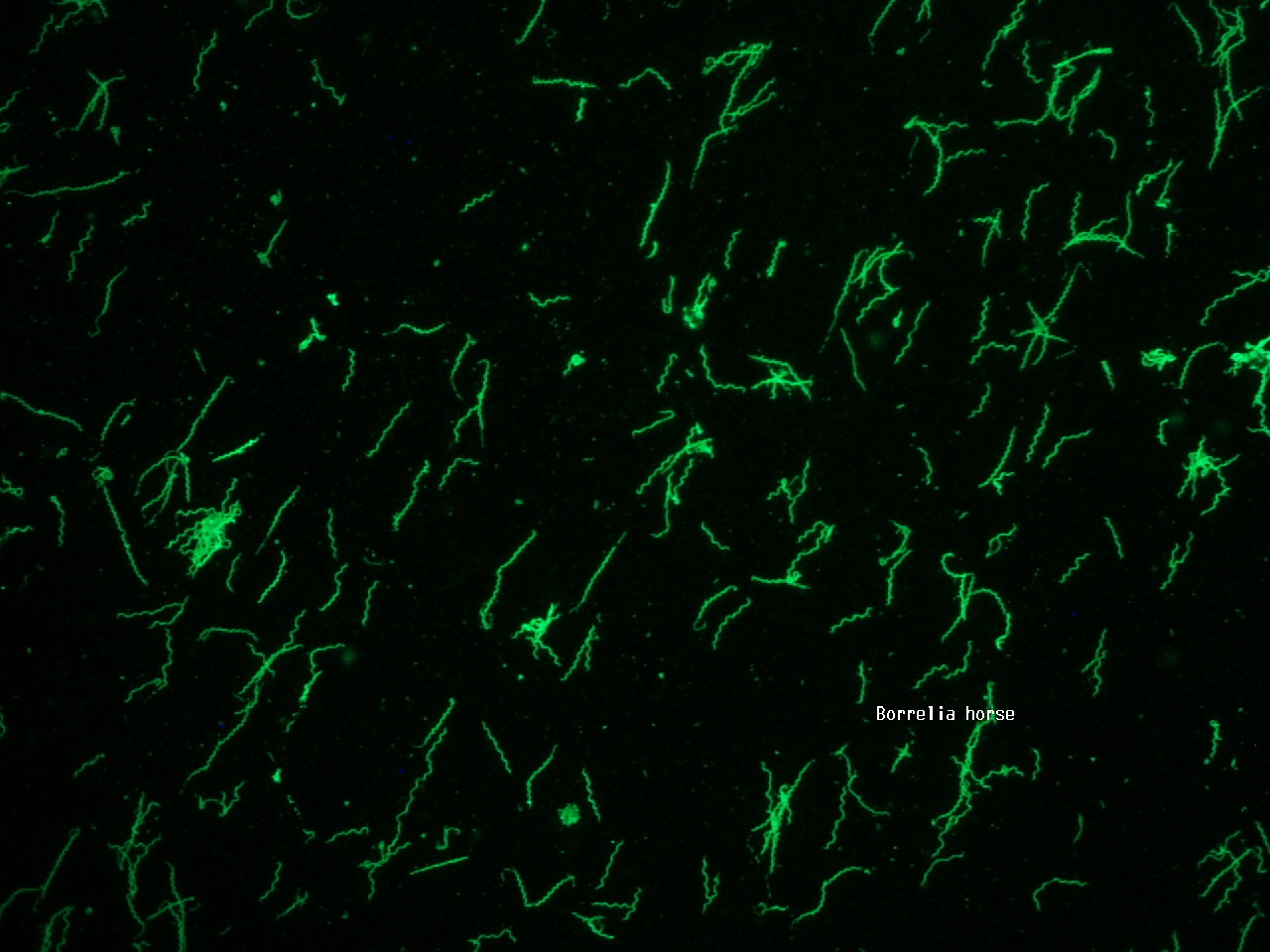 Borrelia