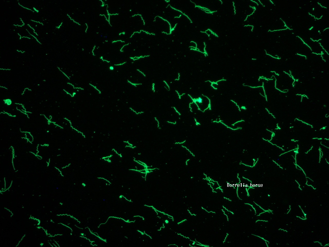 Borrelia