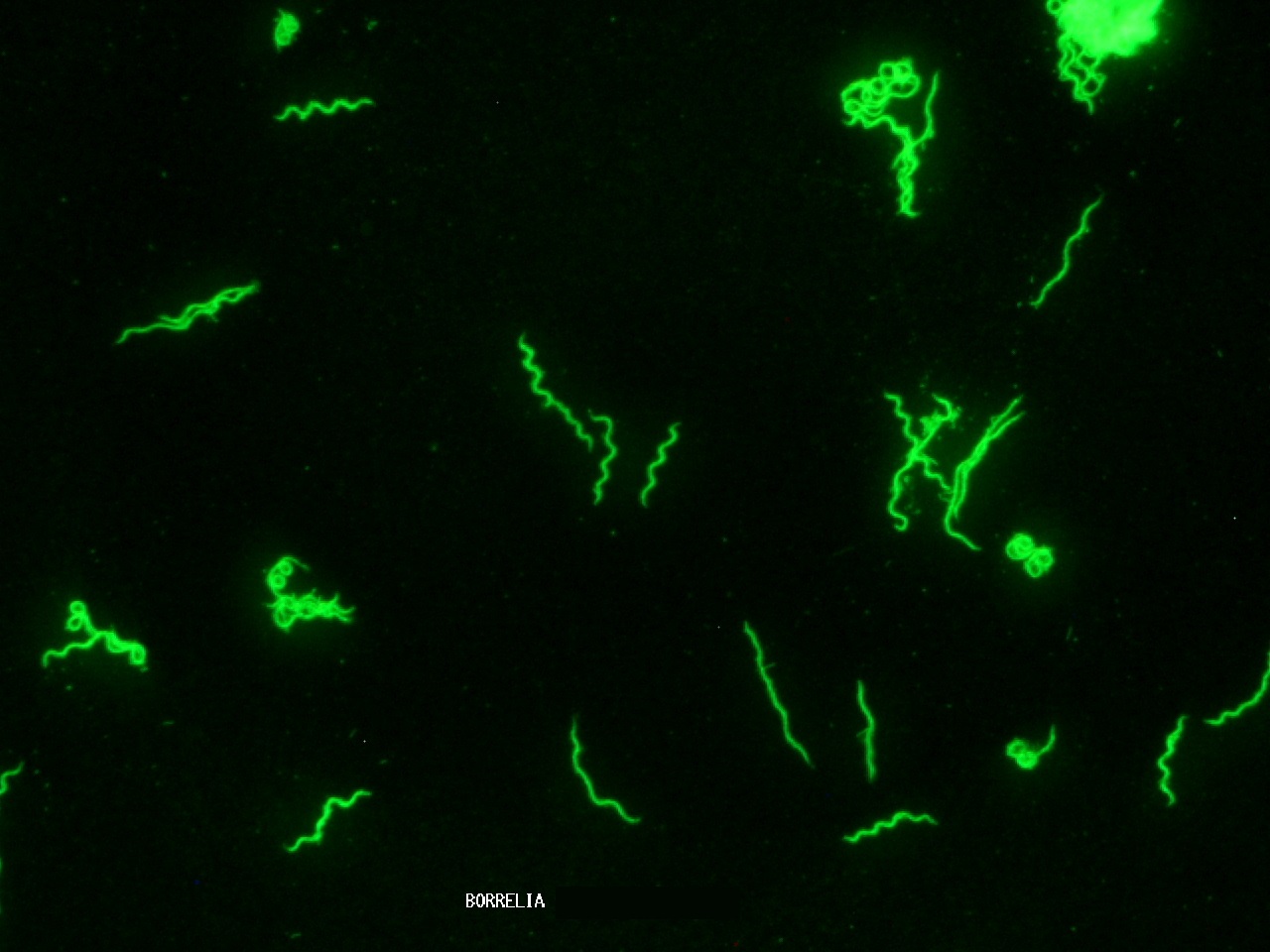 Borrelia