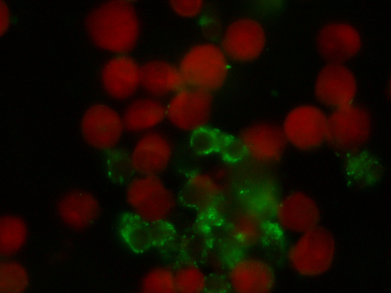 RICKETTSIA rickettsii