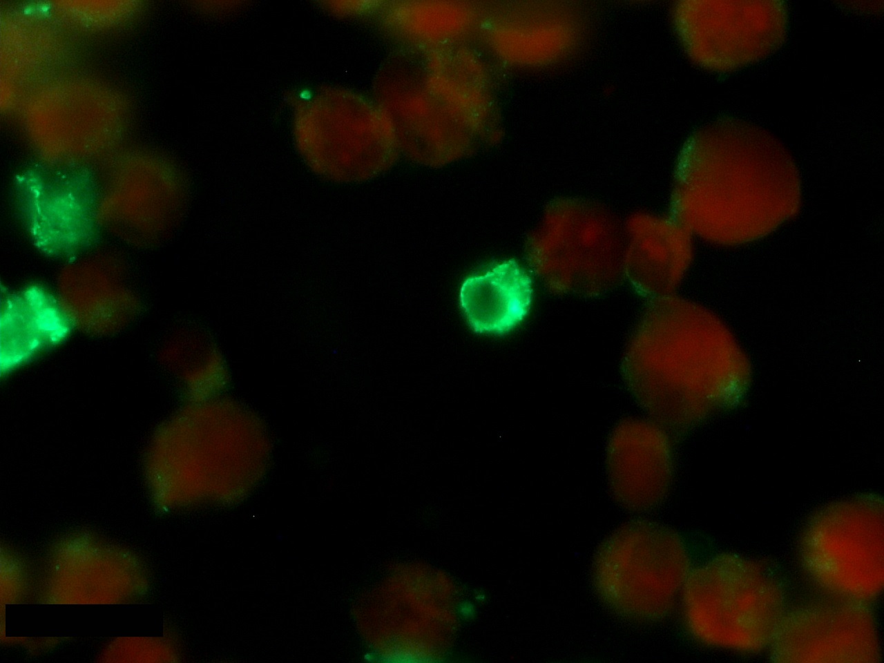 RICKETTSIA rickettsii